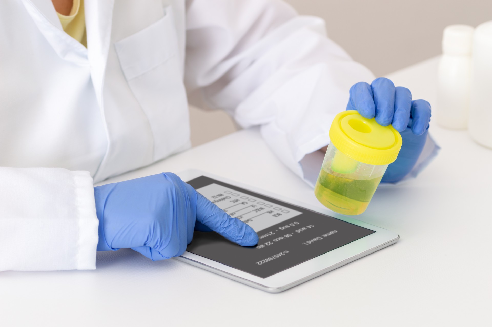 scientist examining a urine sample